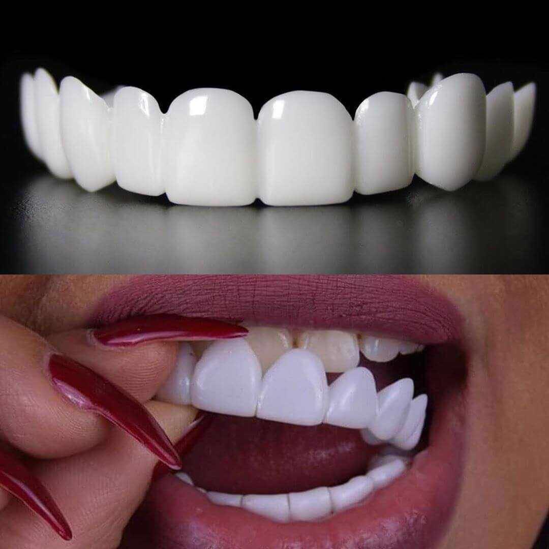 Repressão dos Dentes - Sorria Novamente com Confiança